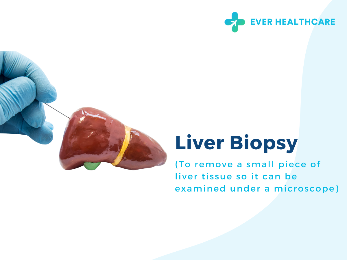 Liver Biopsy in Thailand 2023 Compare Price & Reviews Ever Healthcare